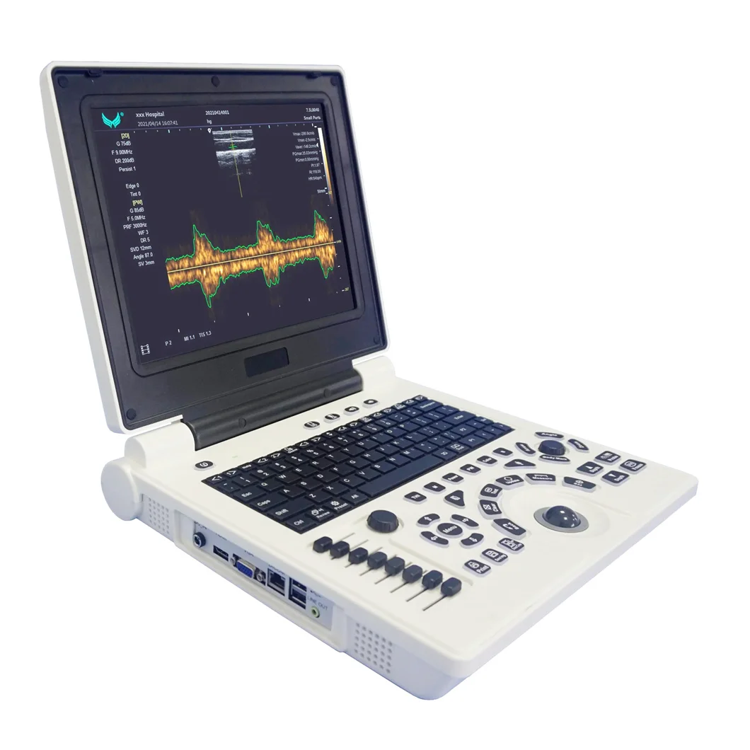 Medical ultrasound instruments Full Digital Portable Laptop BW obgyn 3mhz Ultrasound machine