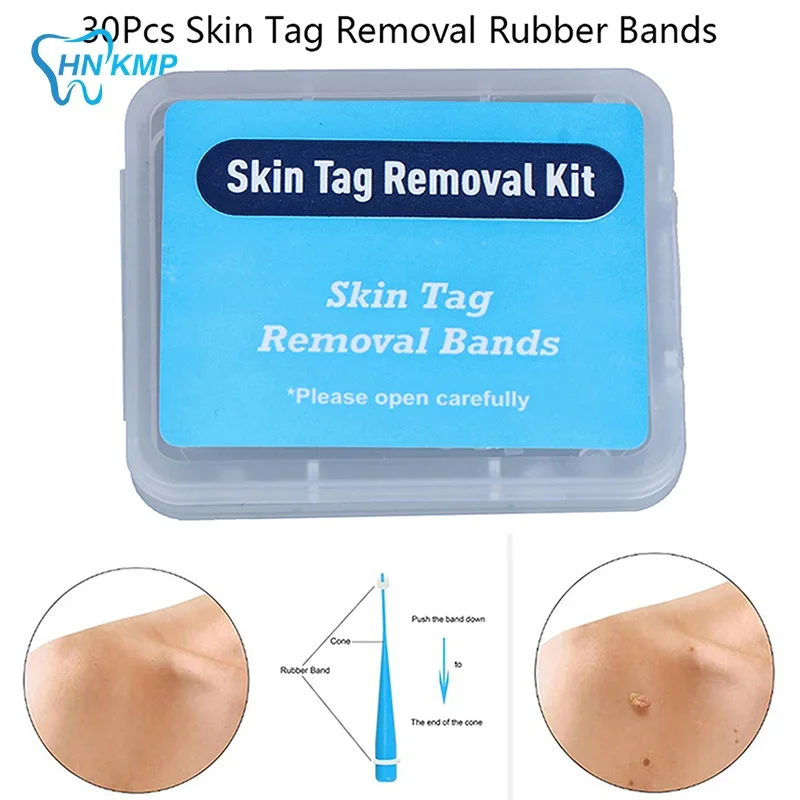 2mm-4mm Remove Skin Tag Shrink Rubber Ring 20pcs/box Non Toxic Health Beauty Skin Care Tools Tag Removal Mole Wart Removal 4
