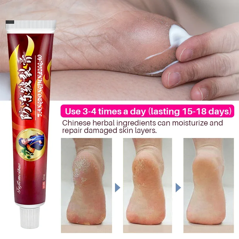 1Pcs Anti-Drying Crack Ointment Hand Foot Heel Cracked Repair Plaster Removal Dead Skin Care Chinese Herbal Medicine Cream S101