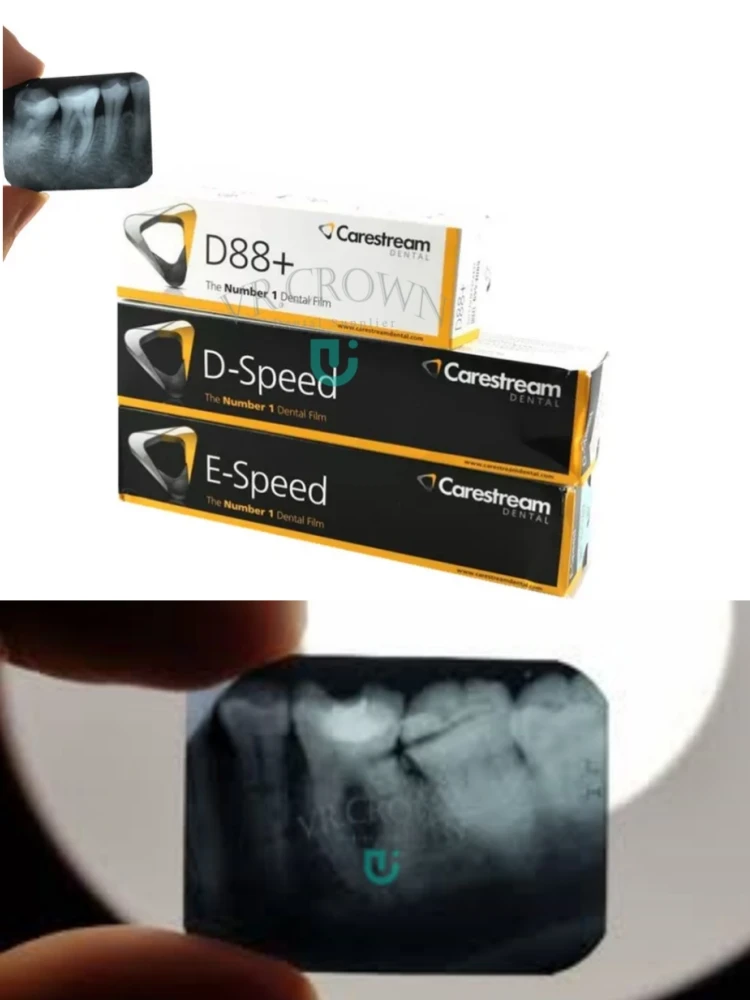 Dental Kodak Carestream E-Speed X-Ray Films Intraoral Digital Xray Imaging Film for Dental Scanner