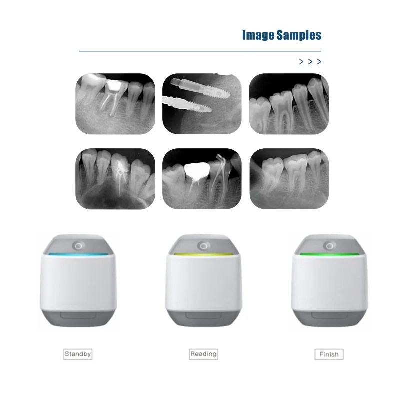 New Digital Dentl Image Plate Scanner Smart Intraoral Phosphor Psp Scanner Auto Denal X Ray PSP Scanner