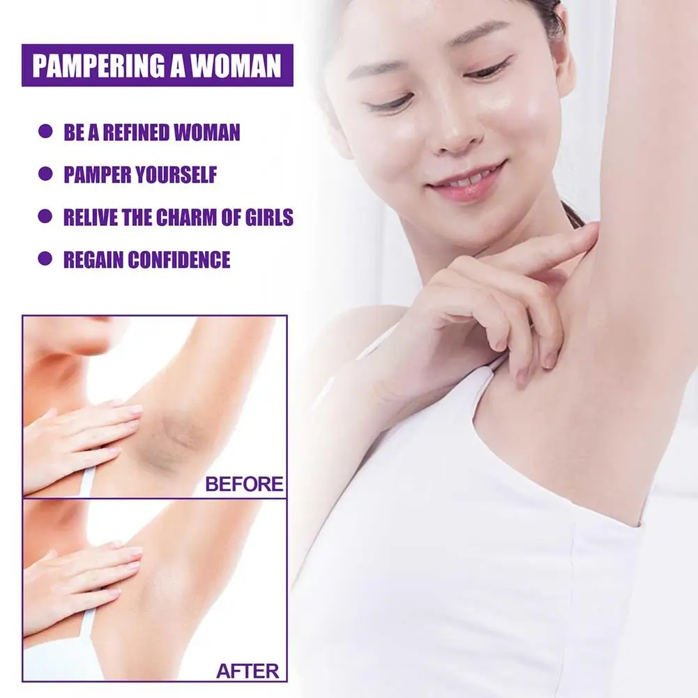 20g Private Part Whitening Cream Underarm Intimate Whitening Cream Removal Body Intimate Knees Bleaching