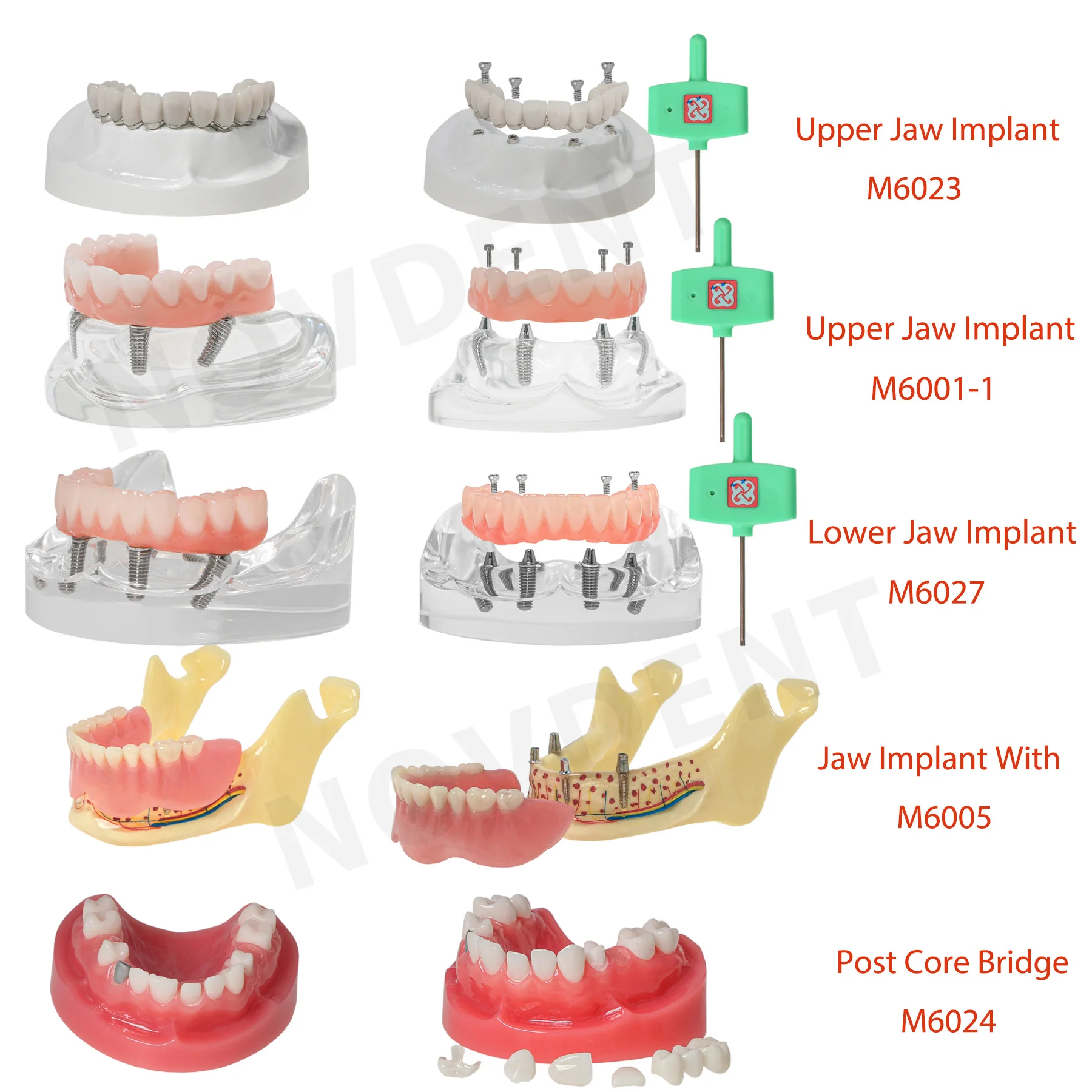 Dental Implant Overdenture Restoration Style Upper Lower Teeth Model Typodont