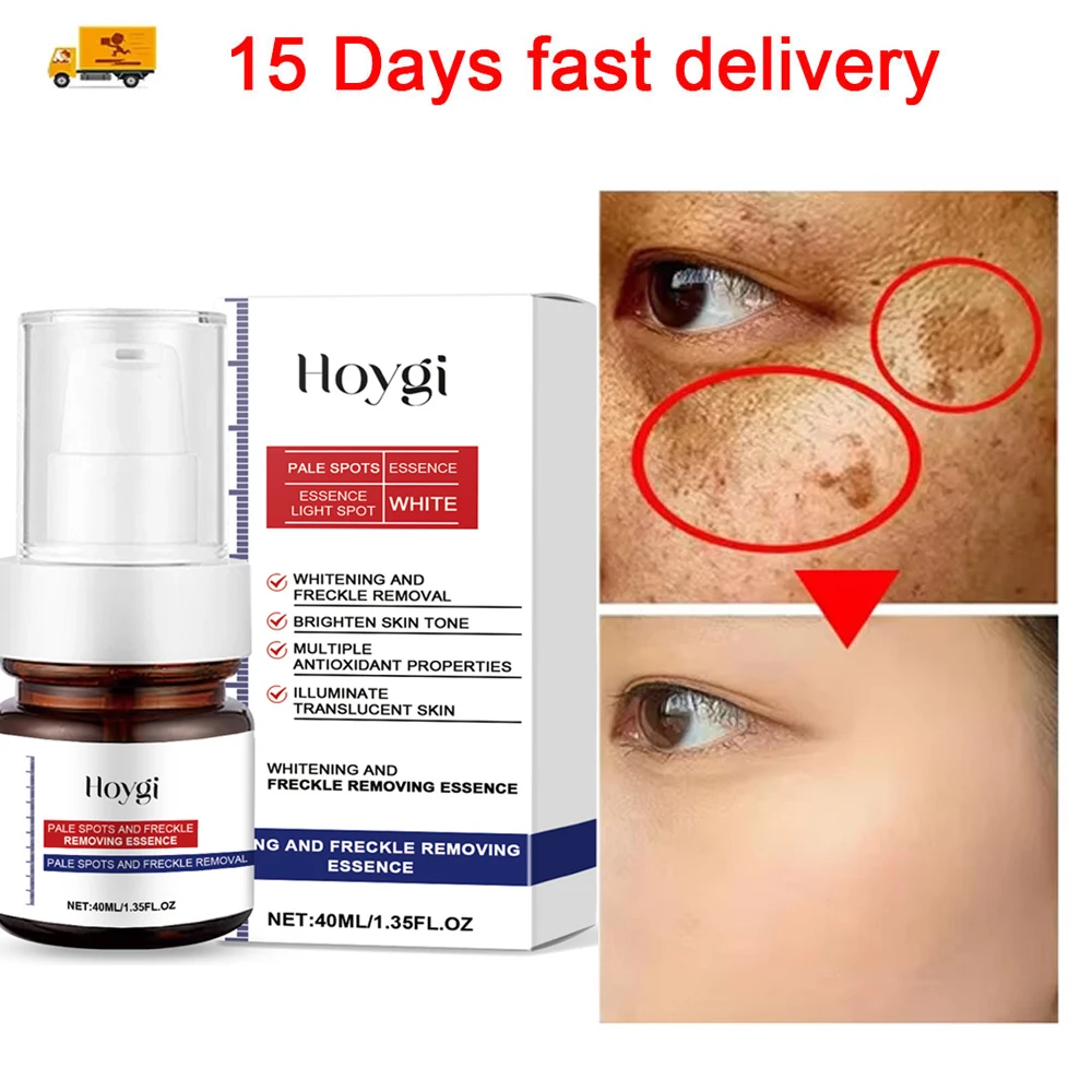 

Powerful Dark Spots Remover Whiten Serum Cream Vitamin C Skin Brighten Essence Removal Melasma Dark Spots Moisturizing Skin Care