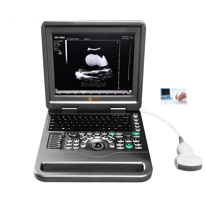 Abdominal Obstetric Urology Gynecology Ultrasound Black and White SUN-806A