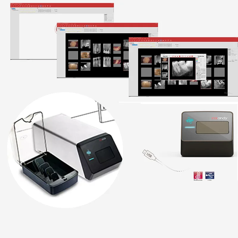 

Стоматологический интраоральный рентген-сканер VV Dental для цифровой визуализации, сканер фосфорных пластин, портативный рентген-сканер для зубов и система обработки изображений