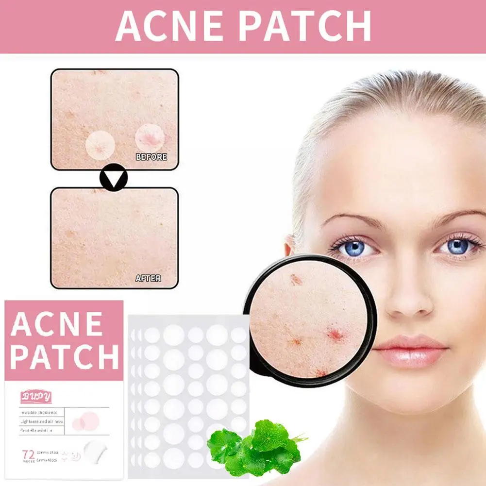 Patch autocollant imperméable pour le traitement de l'acné, outil de suppression des boutons, masque facial anti-taches, soins de la peau, 72 pièces