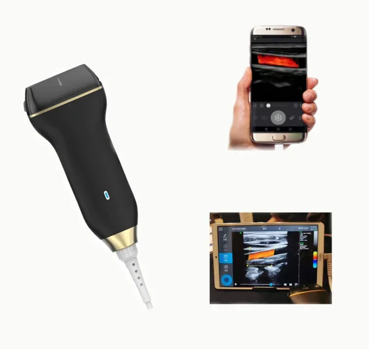 Mobile USB smart color doppler Black and White handheld ultrasound scanner medical wireless ultrasound probe