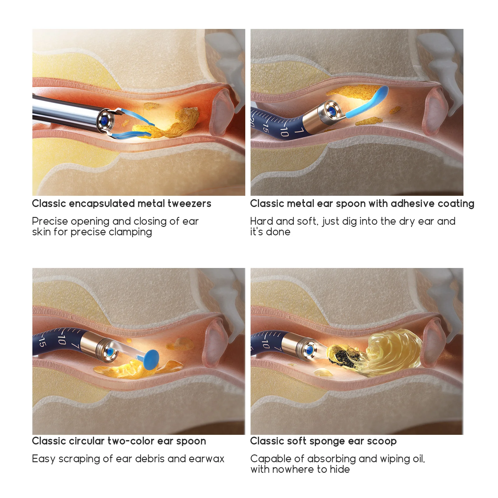 Original Bebird Accessories Earsight Plus Ear Tips Replacement Tool 14pcs/Set - Image 4