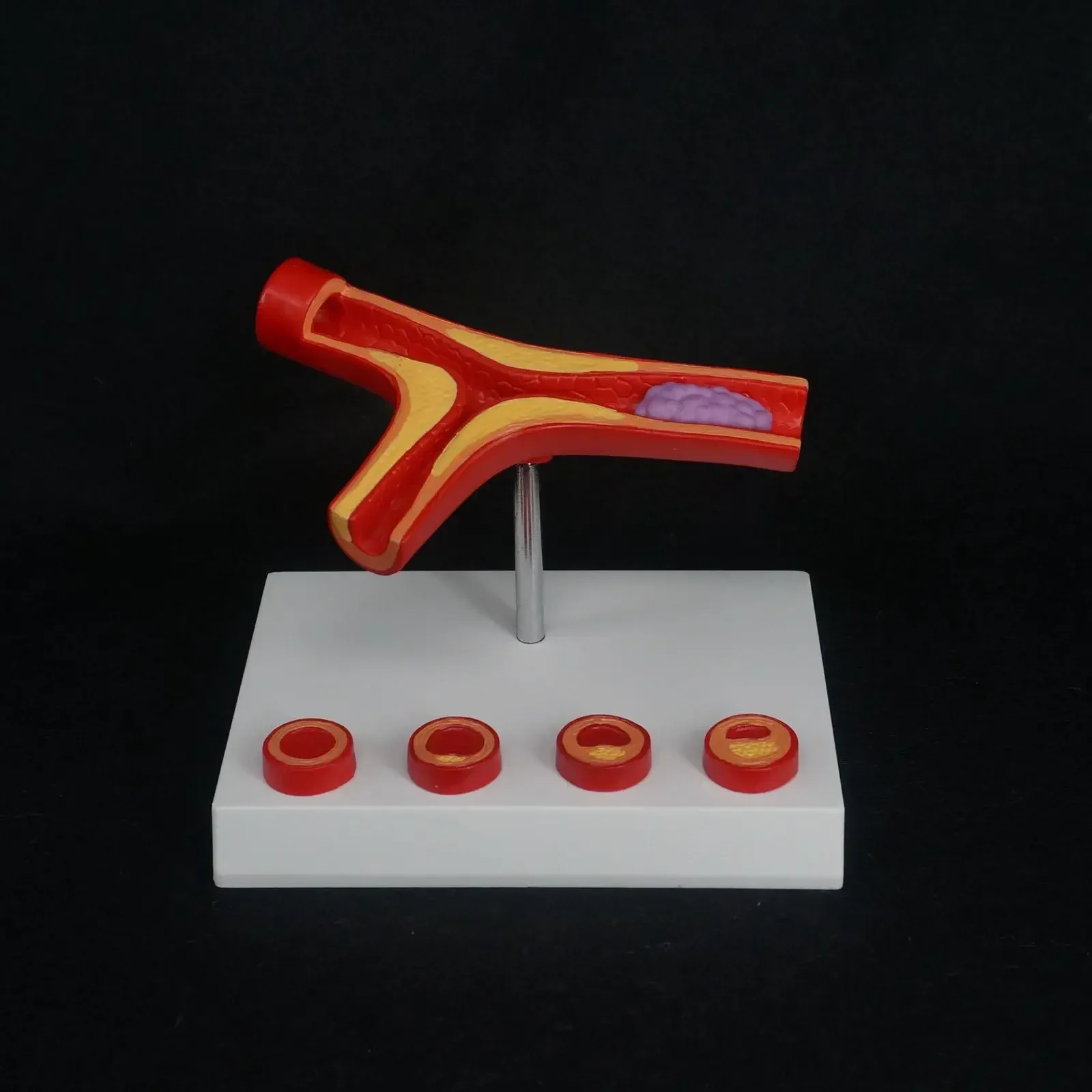 

Медицинская модель артериального атеросклероза человека из ПВХ с помощью тромбового сосудистого артеритролероза, образовательный инструмент для моделирования