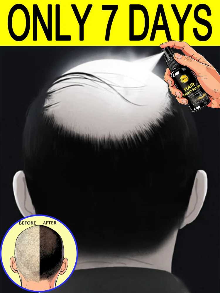 Generation-2,M-shaped,to solve hair problems and protect your scalp health,care tool,Hot selling in Japan