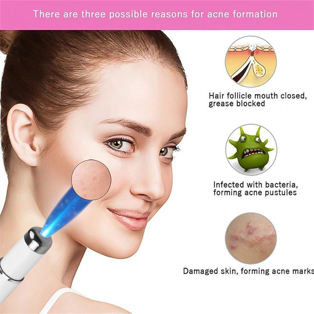 Portable Blue Light Reshaping Laser Pen Varicose Vein Treatment Scar Removal Tool Freckle Acne Treatment Beauty Tool