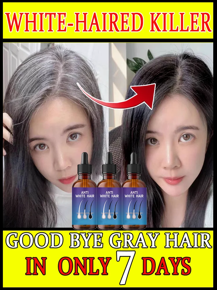 For scalp growth black hair anti-gray  hair Anti-white  products 100% effective quickly turns white into black 7 days