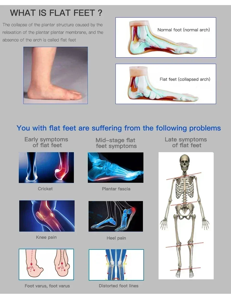 AB Professionelle Einlegesohle zur Fußgewölbeunterstützung für Plattfüße, Schuhkissen, orthopädisches Polster für Fahrrad, Fußball, Laufen, Sport – Detail 5