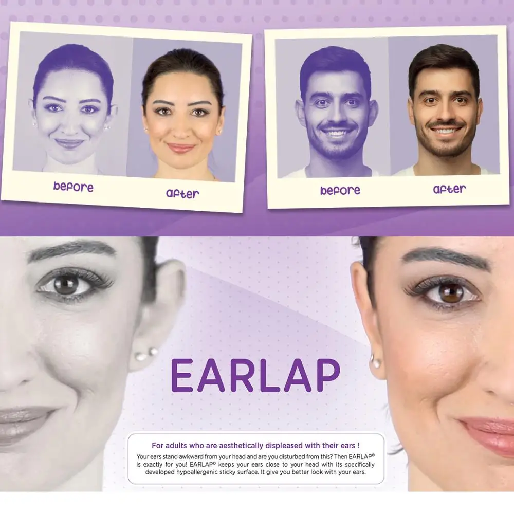 EARLAP Ear Concealer Aesthetic The Protruding Ear For Bands That Adheres Instantly Effect Ear Trimmer Cosmetic Safer Comfortable