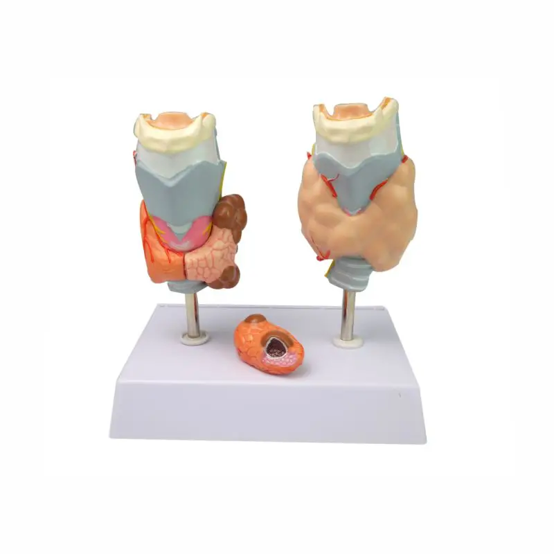 

Human Larynx Anatomical Model Thyroid Pathological Model, human pharyngeal pathology detachable throat anatomical model