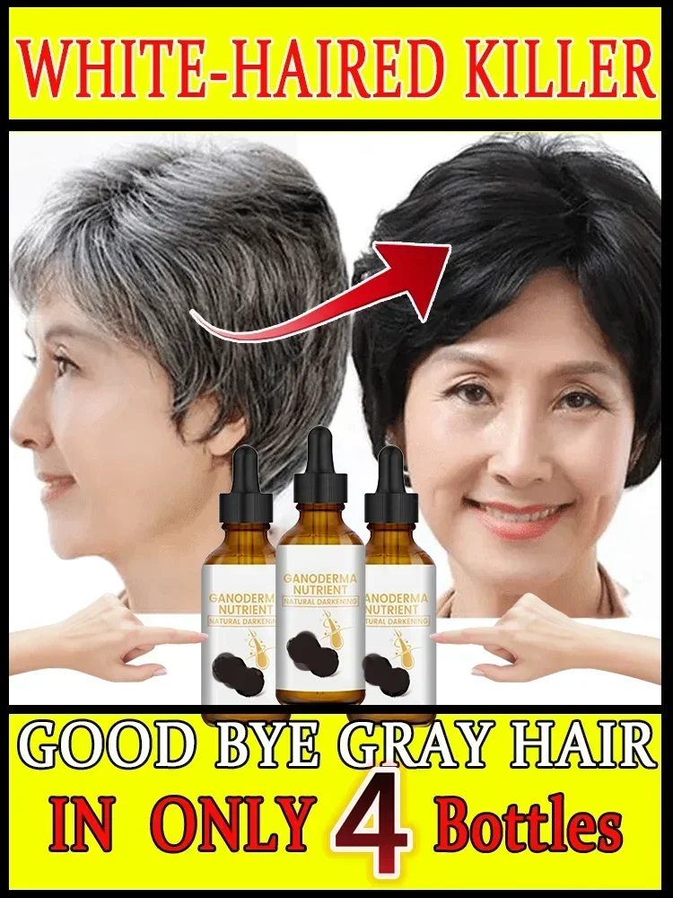 Turn white hair into black hair, remove white hair, turn gray within 7 days, restore natural healthO