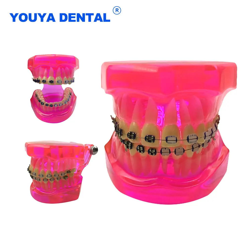 

Dental Typodont Orthodontic Model Implant Teeth Models Resin With Brackets Teaching and Studying Dentistry Communication