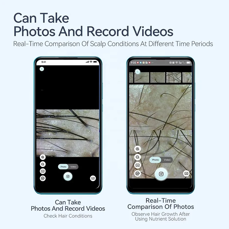 Scalp Detection Device For Home Amateur Use High cost Performance Authentic 200 X Magnifier Skin Analyzer Machine USB Connection