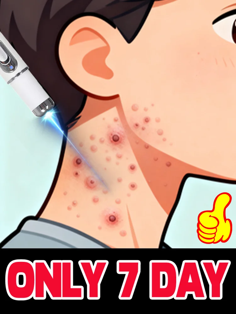 

Worry-free wart removal,blue light pen solve warts,free shipping,hotsale wart care