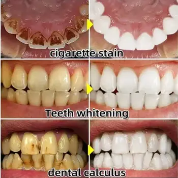 Suero reparador de encías rápido, alivia la retracción de las encías, previene el recrecimiento, blanquea los dientes, elimina la placa amarilla, las manchas, la caries y el dolor de muelas. Pasta dental. 10 best sales Chiclete - №10