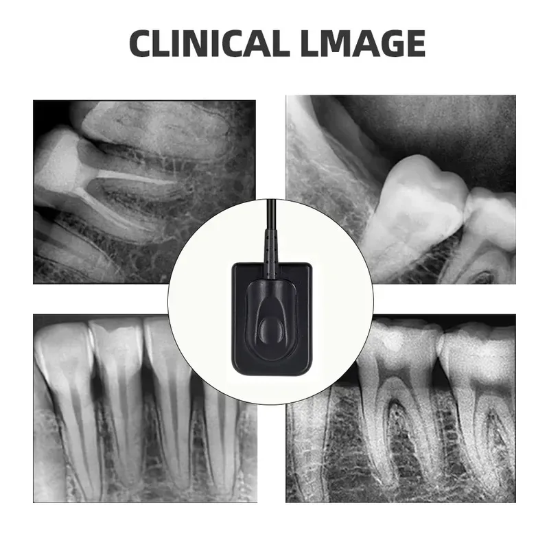 High-Definition RVG Sensor for Handy Sensor Oral Portable Digital X-Ray Sensor