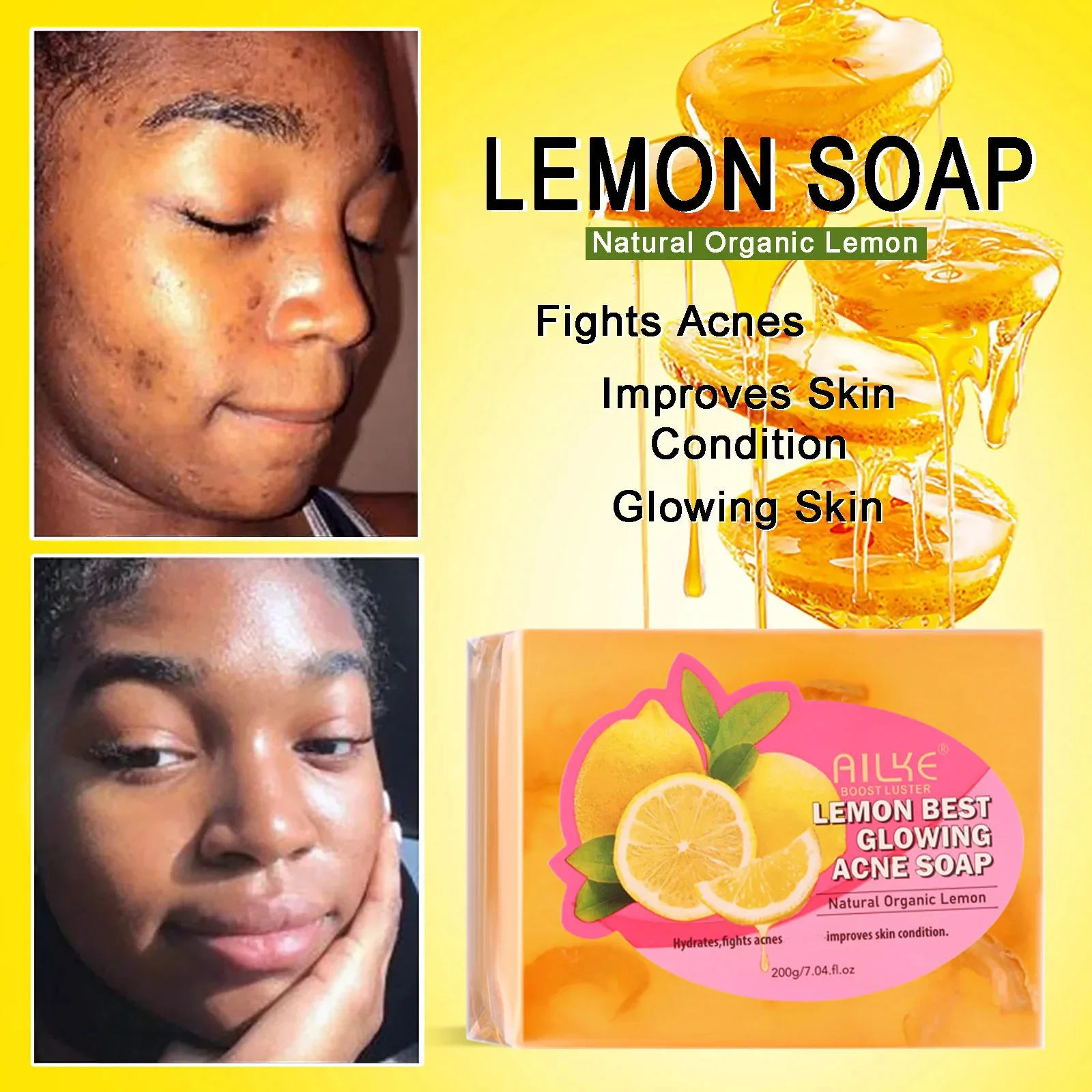 AILKE Dark Spots and Acne Remover Soap Bar, Whitening Skin with Natural Lemon, Olive Oil, Women Daily Face and Body Wash, 200g
