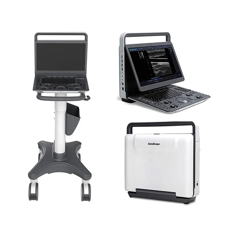 

MSK Ultrasound TDI CW Color Sonoscape E2 E3 & Sonoscape E1 Usg