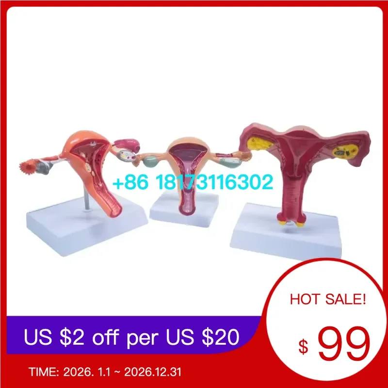 CRW Female Uterus and Ovary Anatomical Model, Vagina Model Plastic Uterus Model, Normal Uterus Model