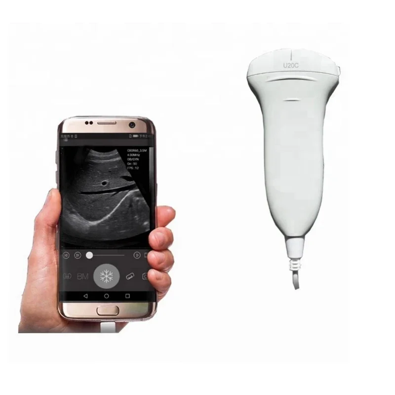 Discounted iphone & Android connect wireless ultrasound machine Convex linear probe / wireless USG