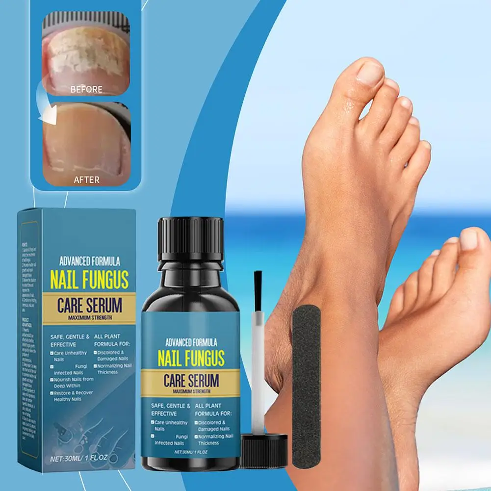 Nail Fungus Tratamento Soro, Foot Repair Líquido, Toe Infection Gel, Paroníquia Remoção, Anti Onychomycosis Fun, Anti 30ml, V0U1