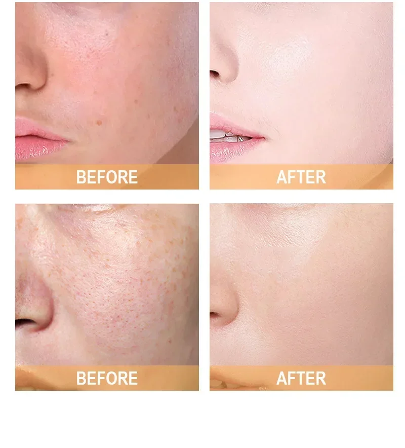 حمض الجليكوليك العادي 7% محلول التنغيم 240 مل لوشن تقشير الوجه AHA تونر اشراق العناية بالبشرة ترطيب جوهر #3