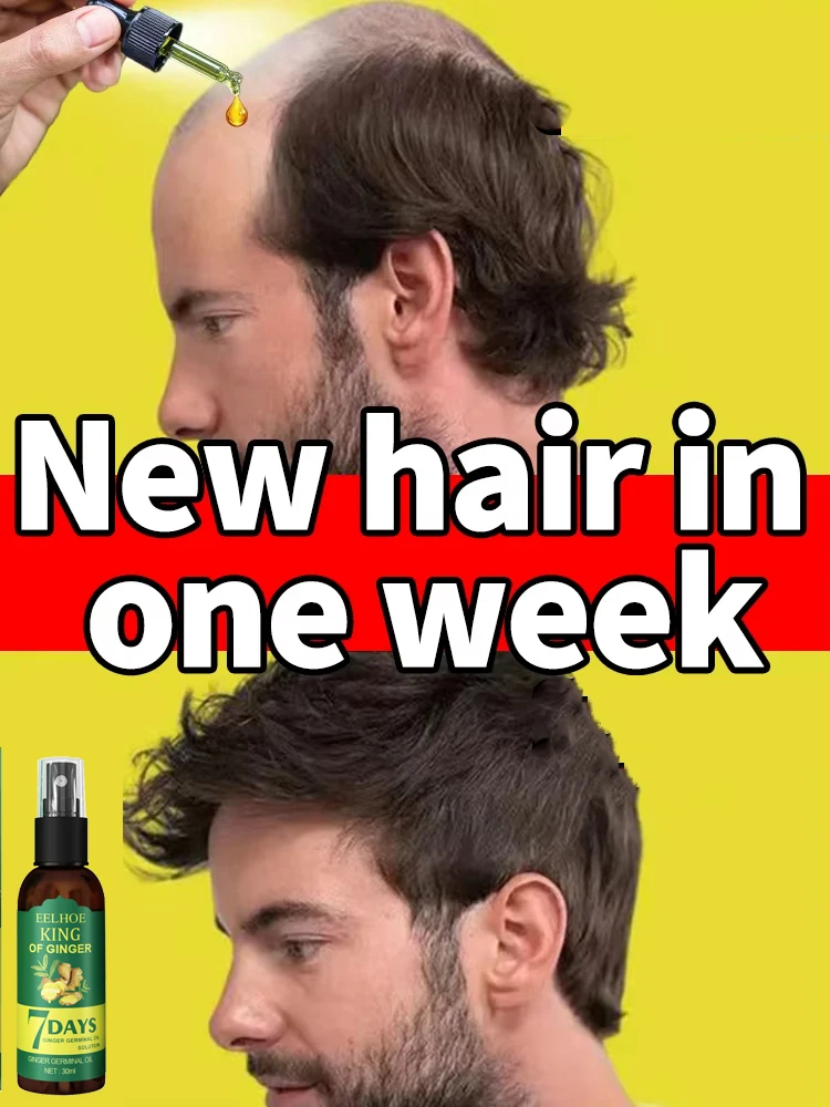 

Ginger Hair-CARE Serum, Preventing Hair Loss Hairs Thicker Essence Hairs Nourishing Care for Stronger Thicker Longer