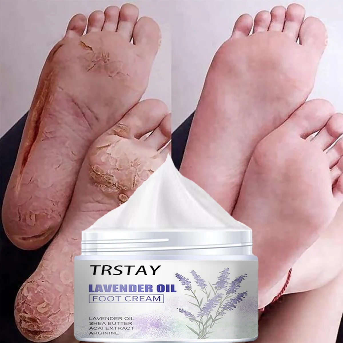 Traditional Chinese Lavender Oil Anti-Drying Crack Foot Cream Heel Cracked Repair Cream Removal Dead Skin Hand Care for Family