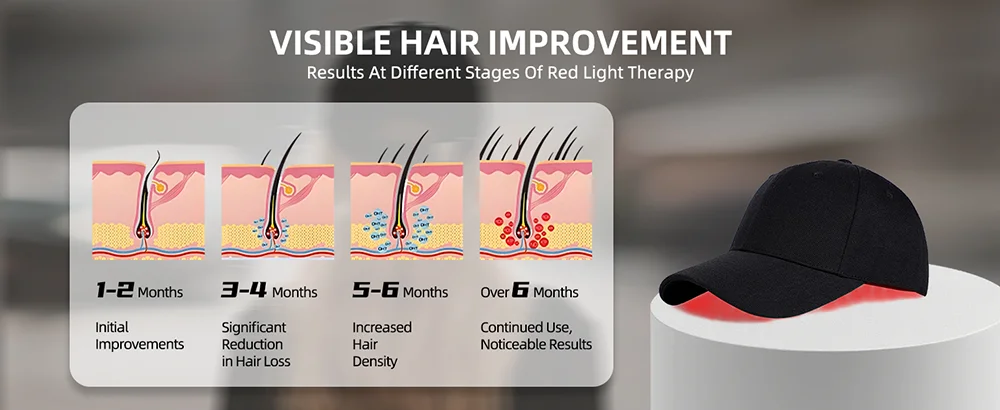 Red Light Therapy Cap for Hair, Upgraded 96 LEDs Red Light Therapy for Head, Infrared Light Therapy for Men & Women with Timer