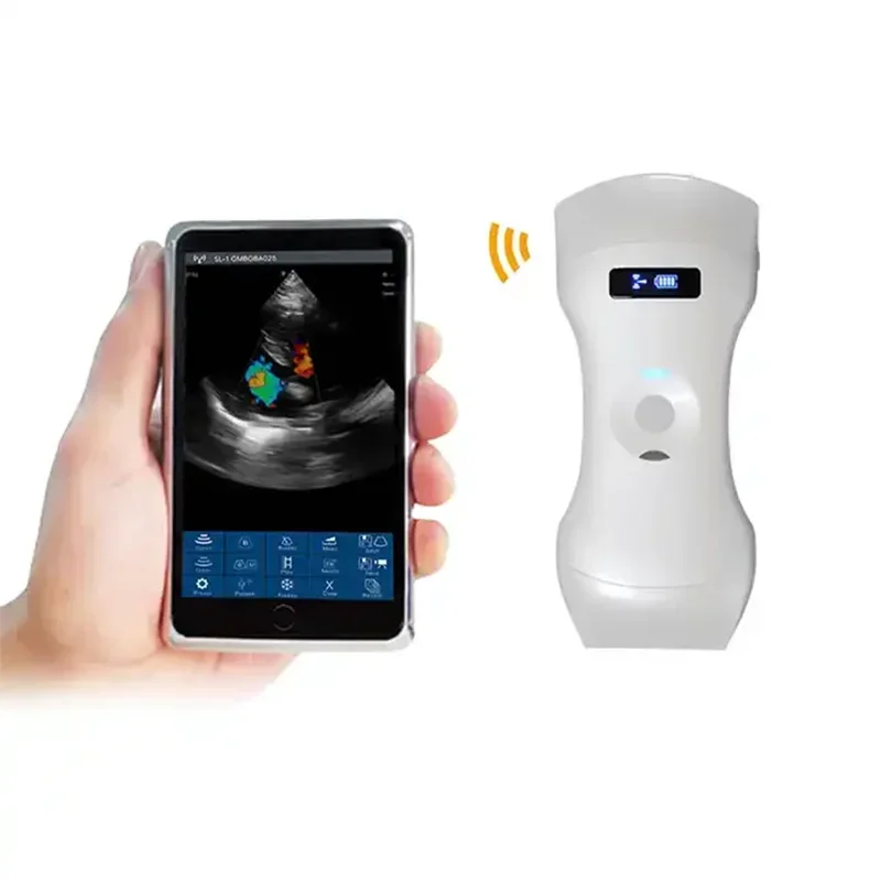 Sonografia Inalambrica Con Sonda  USB Triple En 1 Sondas Lineales Y Convexas Para Smartphone Exploracion Port