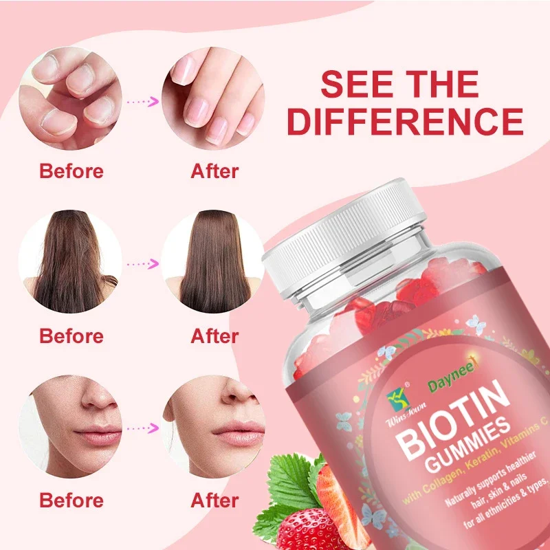 

60 Capsules Biotin Soft Candy Improves Skin Nail Health While Promoting Hair Growth Enhancing Skin Elasticity Health Food