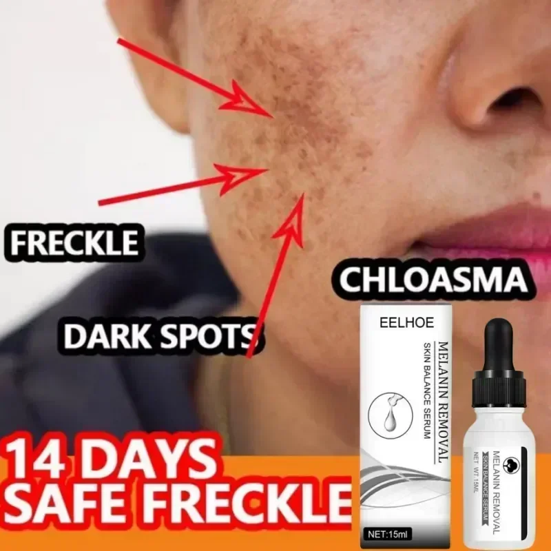 Effective Dark Spot Removing Whitening Lightening Spot Essence Chloasma Replenish Water Beautify Skin Moisturizing Serum