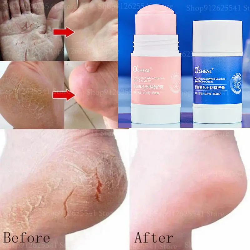 1Pc Vaseline Anti-freezing Anti-Dry Cracked Foot Hand Cream Smooth Wrinkle Balm Stick Moisturizing Removal Dead Skin Feet Care