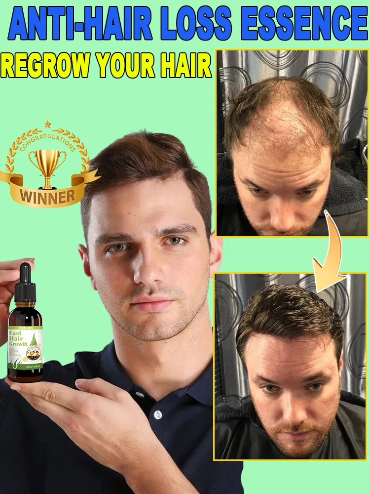 

Prevent hair loss and say goodbye to baldness