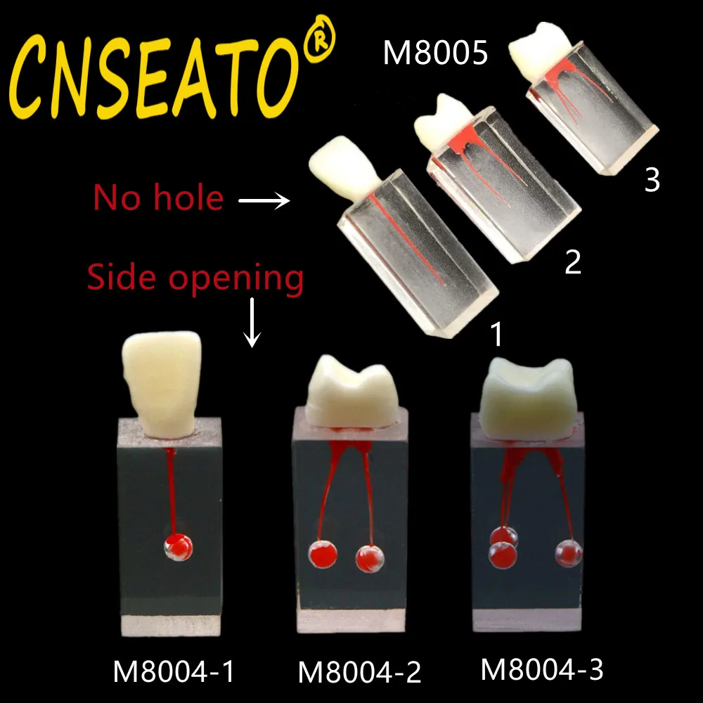 Dental Model Endodontic Root Canal Block Practice Teeth Pulp Cavity Resin Study Endo Training Tooth RCT Demo Student Teaching