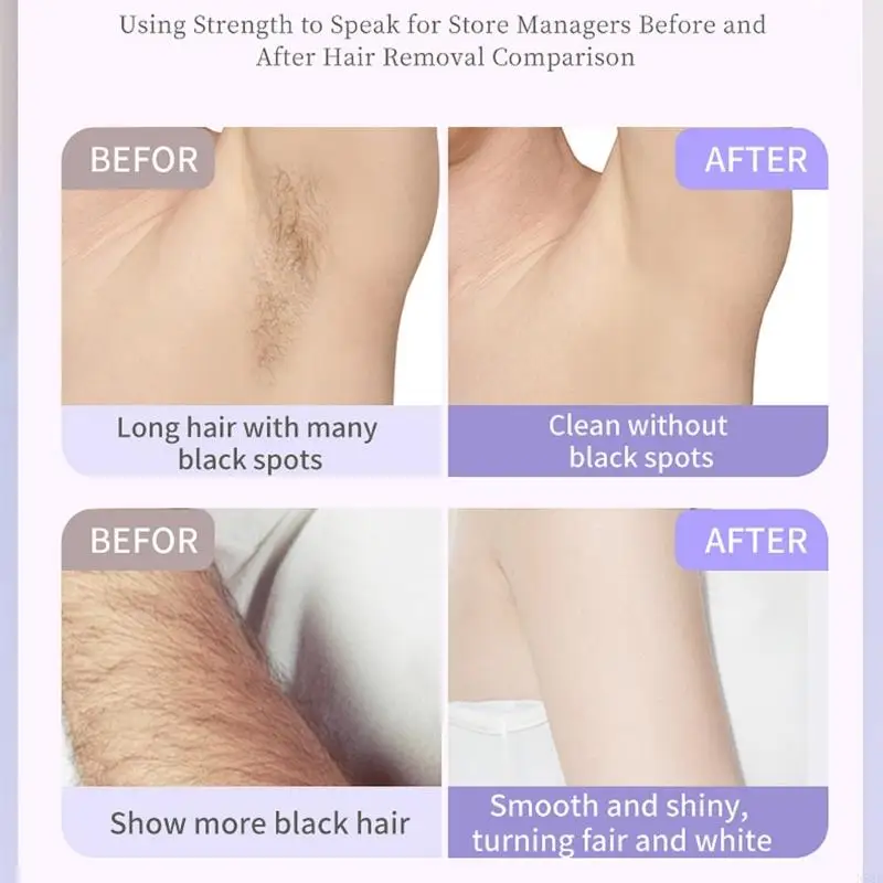 Elegante textura in plastica per rasoi a doppia testa a doppia testa da donna adatto a tutti i tipi pelle comprese le aree