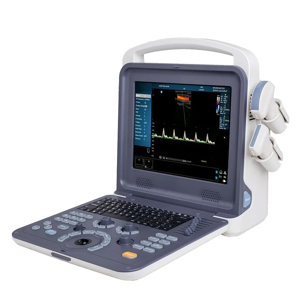 Portable PC Platform Color Full Digital Ultra Sound Scan Portable Laptop Ultrasound Machine