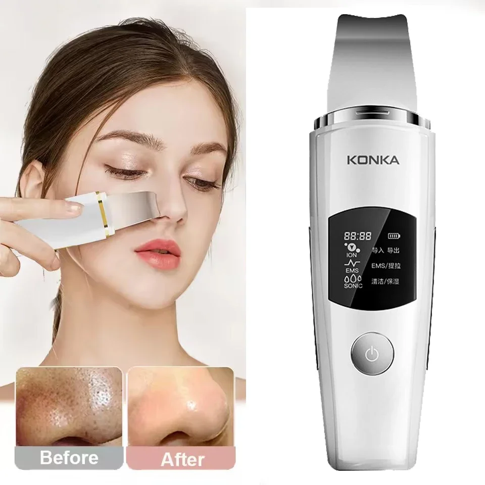 جهاز تنظيف البشرة بالموجات فوق الصوتية الصغيرة الاهتزاز ملعقة الوجه مزيل الرؤوس السوداء جهاز تنظيف الوجه بالموجات فوق الصوتية للعناية بالبشرة أداة نظيفة