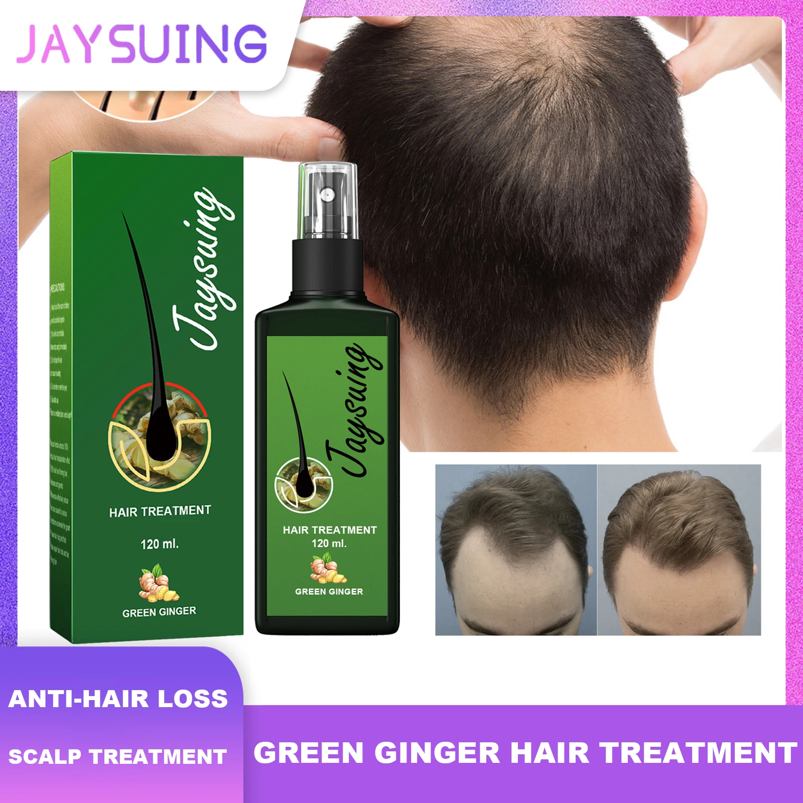 

Jaysuing лечение волос зеленый имбир против выпадения волос предотвращение облысения лечение кожи головы восстановление корней красота здоровье уход за волосами унисекс