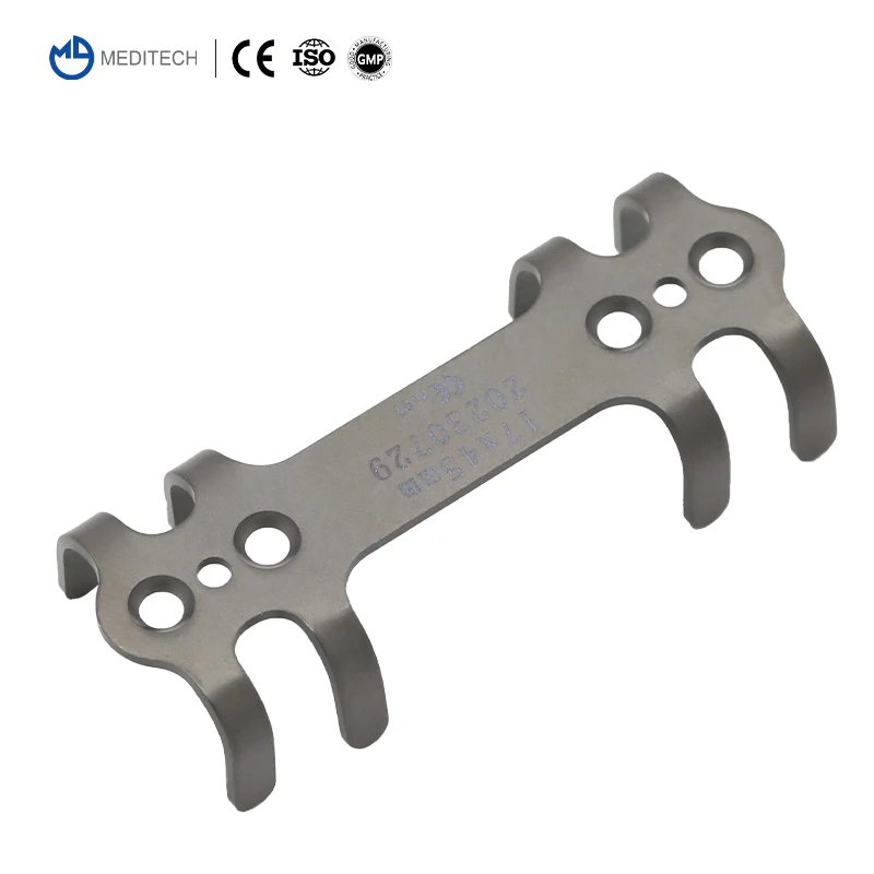 Orthopedic Titanium Patented Rib Plate Orthopedic Implants for Rib Fractures