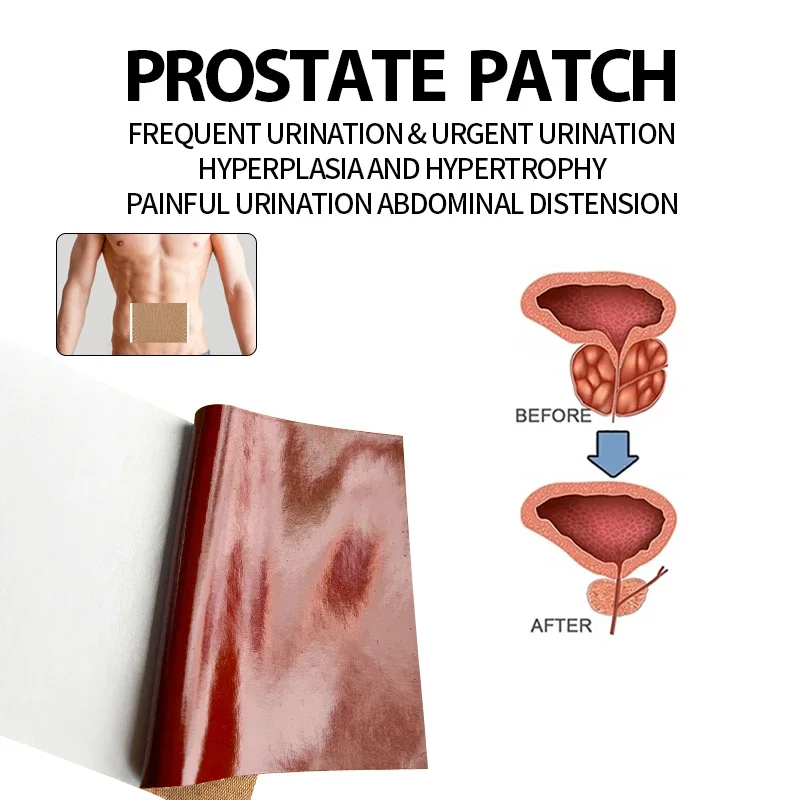 4PCS Prostatic Treatment Navel Patches Prostatitis Prostate Man Urethritis Urology Health Care Strengthen Kidney Medical Plaster