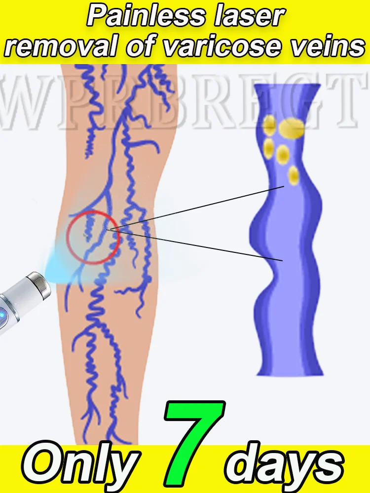 

The new second generation upgrade quickly solves the problem of varicose veins and can promote blood circulation