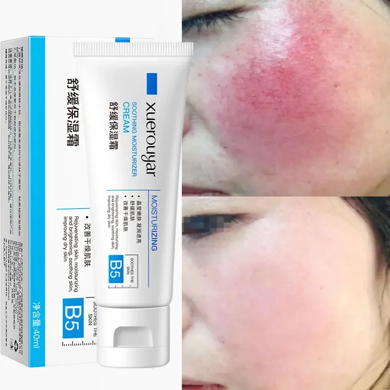 7 Day Repair Facial Redness Cream Soothing Redness Repair Skin Rosacea Red Blood Improve Sensitive Skin CareKorean Cosmetic 40ml