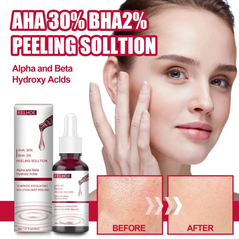 Hyaluronic Acid Revitalizing Fruit Acids Acne Deep Exfoliation Skin Rejuvenation Skin Resurfacing Acne Scar Fading